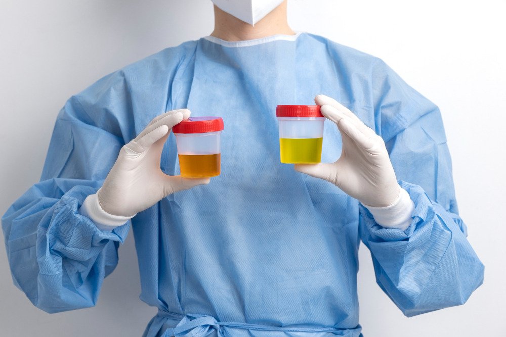 A healthcare professional holding urine samples in both hands